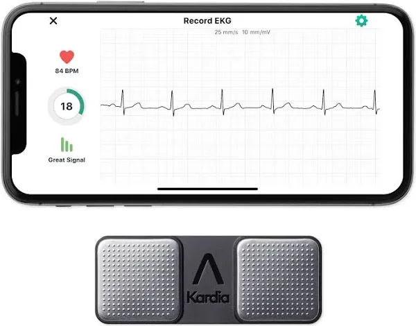 AliveCor KardiaMobile Personal EKG Monitor