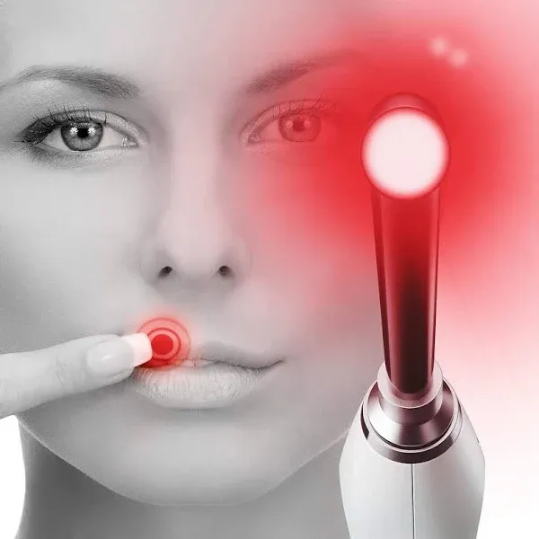 Luminance Red The Proven Cold Sore Device for Pain Relief and Lip Sore Management