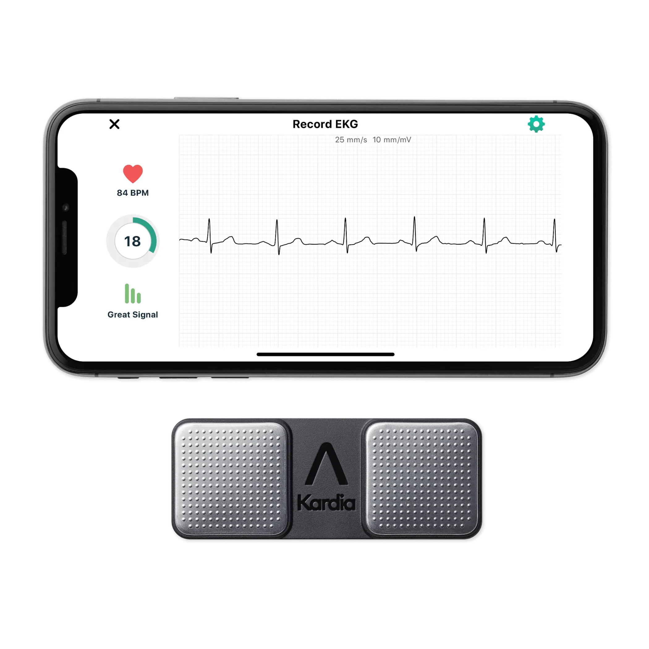 AliveCor - KardiaMobile Personal EKG Monitor - Black